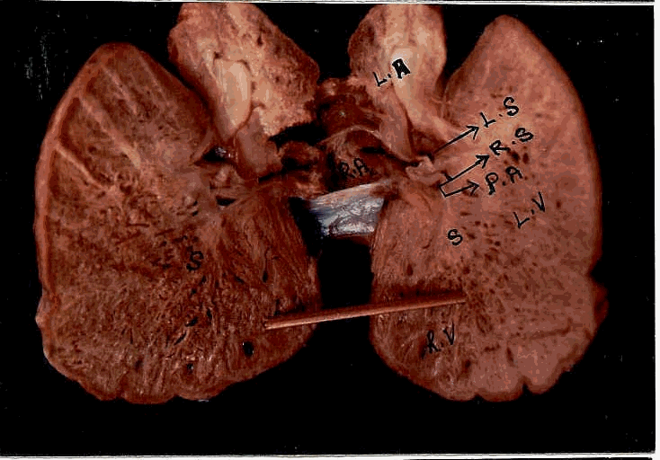 Structure of  sea turtle