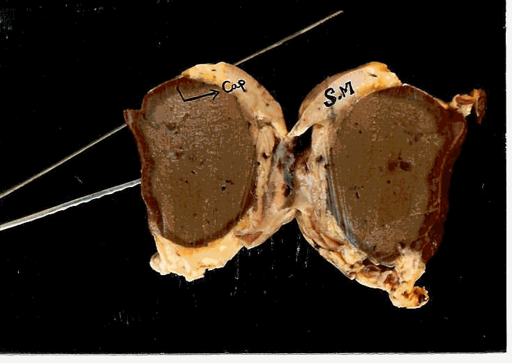 Structure of  sea turtle